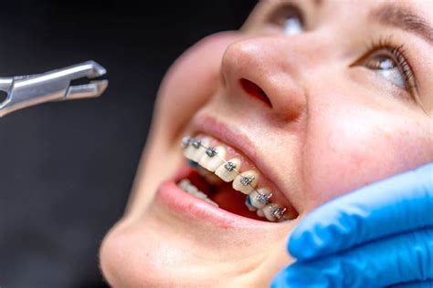 Understanding Bracing Pain and How to Ease It
