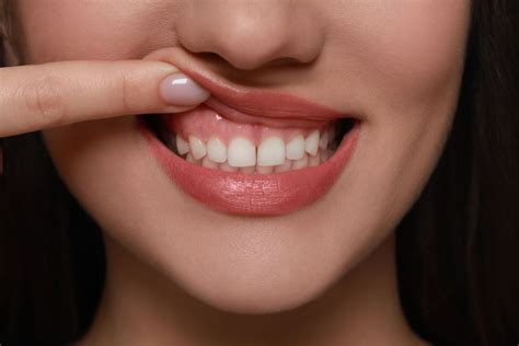 What You Can Do Everyday for Healthy Gums