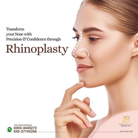 Rhinoplasty | Rhinoplasty, Nose reshaping, Facial plastic surgery