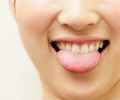 Is a Lisp a Speech Impediment?