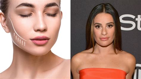 What is Buccal Fat removal? Cost and more explored as Lea Michele selfie highlights viral ...