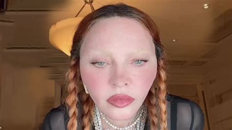 'Unrecognizable' Madonna has likely spent $100,000 on surgery including a face lift & fat ...