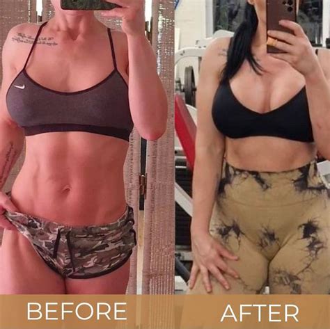 How Much is a Boob Job? Breast Surgery & Implant Cost