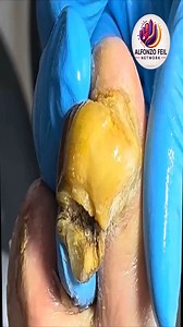 25K views · 135 reactions | Safe and Simple Tips for Daily Toenail Care  #NailCare #CleanRoutine #GentleHabits | Alfonzo Feil | Facebook