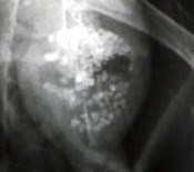 Duck swallowed alien?