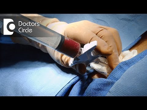 How does one collect stem cells from the donor? - Dr. Mallikarjun Kalashetty