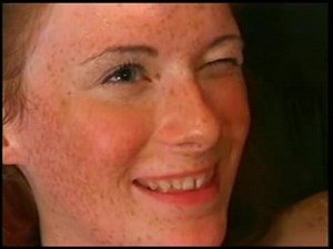 Freckled Teen