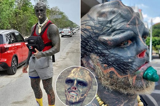 French ‘black alien’ reportedly gets fingers sliced off to create claw