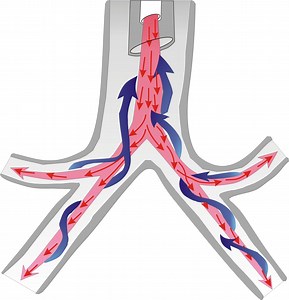 Mechanical Ventilation- Pressure/Volume/Flow loops - Critical Care Practitioner