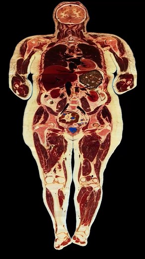 Kent on Instagram: "This video was compiled using photographic medical data from the Visible Human Project The original dataset from the Visible Woman project consisted of over 5,100 horizontal cross-sections of a 59 year old female donor, starting from the top of the head and ending at the bottom of the feet, at 0.33mm intervals. I recently realized that the vertical image data could be extracted from the dataset with a simple reordering of pixels. I used a python script that took corresponding