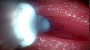 I couldn’t believe what happens INSIDE the penis as sperm passes through (endoscopic footage)