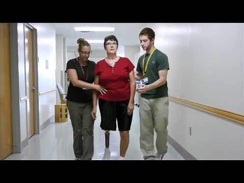 The Amputee Rehabilitation Program