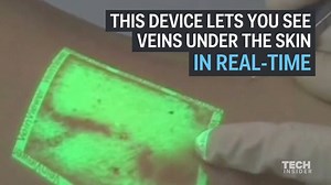 10K views · 26 reactions | Medical Innovations | Sailesh Prasad | Facebook