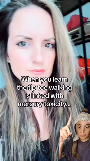 62K views · 1K reactions | Signs of MERCURY TOXICITY in the kids....