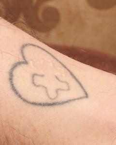 Bad-Tattoo Removal Process! | Addicted2Success