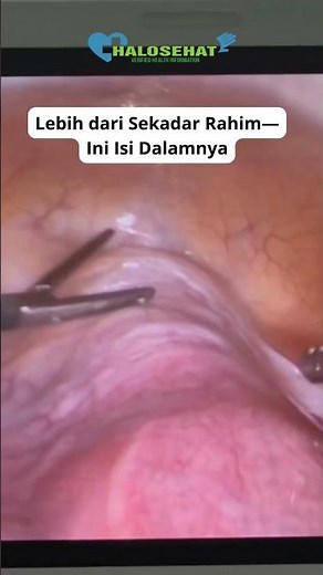 Sistem Reproduksi Wanita : Organ Dalam & Perannya #sistem #reproduksi #wanita #organwanita