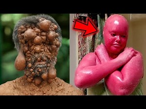 8 MOST Unusual People With UNBELIEVABLE Skin Conditions
