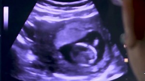 Explainer: What is Georgia's Heartbeat Abortion Law?