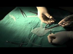 Cystocele and stress urinary incontinence synthetic repair using a self-tailored polypropylene mesh