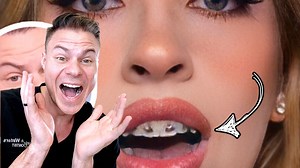 82K views · 969 reactions | This girl looks like a CHIPMUNK after her wisdom teeth removal  #teeth #wisdomteeth | TheBentistofficial | Facebook