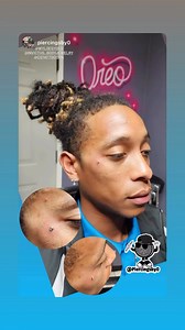 Microdermal implant piercing. Price: $80 (Including hypoallergenic implant-grade titanium jewelry) Piercing hours and prices can be found at our website at www.wyldesydestattoo.com #bodypiercing #piercing #microdermalpiercing #dermalpiercing #wyldesydestattoo #sandiego #piercingstudio | Wylde Sydes Tattoo & Body Piercing