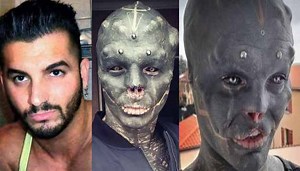 Wow: Body Modification Fanatic Removed His Upper Lip, Ears & Nose To Look Like An Alien!