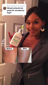 For advanced level results, consider electrolysis or laser hair removal. #strawberrylegs | RitaspeaksSkin