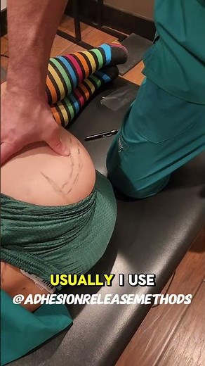 How To FIND Adhesion On The Sciatic Nerve 🎯