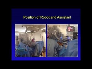 Doç. Dr. F Ayça Gültekin: Robotic Ventral Mesh Rectopexy: Technical Video