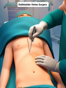 Medical 3D visualization for anatomy education.” Educational medical 3D animation For learning purposes only Non-graphic • Not real footage #medicaleducation #3danimation #anatomylearning #sciencevisuals #healthknowledge