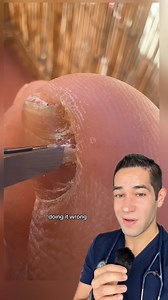 Rate this on a scale of 1-10, and see @FootDocDana if you have this #toe #toenail #ingrowntoenail #satisfying #doctorreacts | Doctor Myro