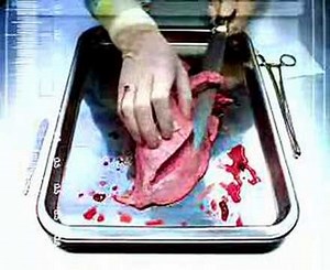 Quit Smoking Campaign - Tar