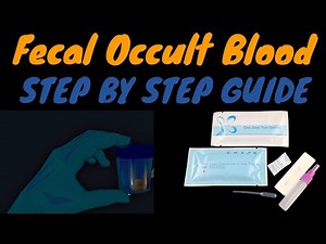 Fecal Occult Blood Guide |MEDICAL LABORATORY SCIENCE