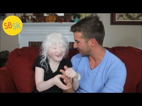 Life as a Blind Albino with a Rare Disorder (Adopted from an Institution)