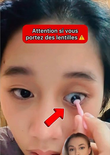 Lentilles et Mystères : Attention aux Risques !