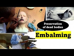 Preservation of dead bodies- Embalming