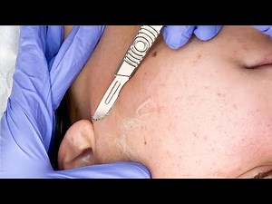 Satisfying Dermaplaning with ASMR sounds