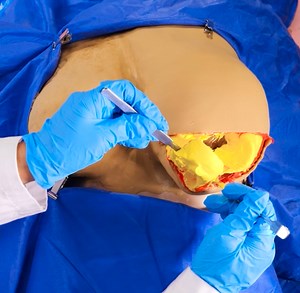 29K views · 83 reactions | Breast Reduction Surgery | Transformazing | Facebook