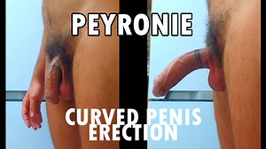 Erection Process (Curved Penis Peyronie)