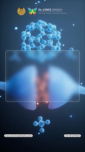 1K views · 2.4K reactions | Endometriosis is not a hormone imbalance...