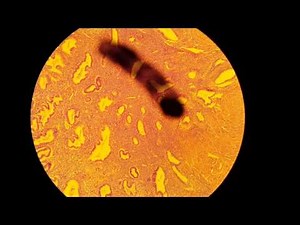 histology of the Uterus - secretory phase