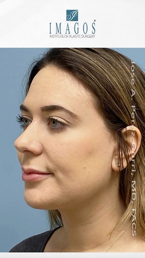 Imagos Plastic Surgery on Reels