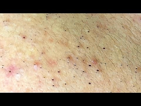 Relax Every Day With Sac Dep Spa #0132