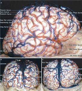 Parietal Craniotomy | Cohen Collection | Volumes | The Neurosurgical Atlas