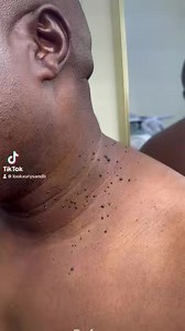 16 reactions | - - - - - - - - - - - - - - - - - - - - - - - - - - -...