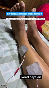 EMS (Electrical Muscle Stimulation) is a physiotherapy technique that uses mild electrical currents to stimulate muscles and produce contractions. It is especially helpful when a person is unable to contract the muscle properly on their own. How EMS Works Small electrodes are placed on the skin over the targeted muscle. The device sends gentle electrical impulses, which activate the nerves and cause the muscle to contract. Benefits of EMS 1. Helps improve muscle strength 2. Prevents muscle wasti