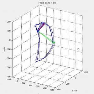 File:Comparison-of-Sum-Absolute-QRST-Integral-and-Temporal-Variability-in-Depolarization-and-pone.0057175.s001.ogv - Wikimedia Commons