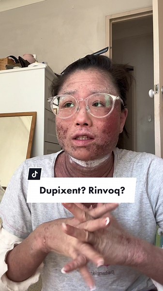 TSW & Medication: Dupixent, Rinvoq & My Journey