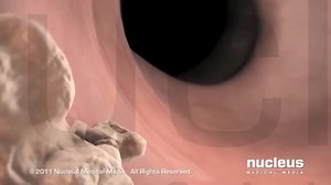 Diagnostic Test: Colonoscopy A colonoscopy is a medical procedure in which a doctor uses a flexible tube with a camera to examine the inner lining of the colon and rectum for signs of disease or abnormalities. #Colonoscopy #HealthLiteracy #DigestiveHealth | Nucleus Medical Media | Facebook