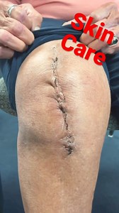 632K views · 1K reactions | 啕 Post-Surgical Incision Healing: What...